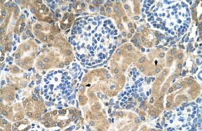 Immunohistochemistry: TM9SF1 Antibody [NBP1-69486]