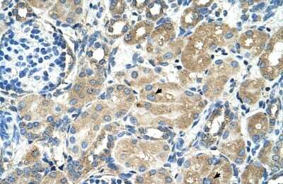 Immunohistochemistry-Paraffin: TM9SF1 Antibody [NBP1-62532]