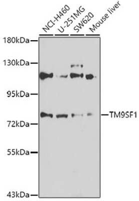 Western Blot: TM9SF1 AntibodyBSA Free [NBP2-93645]