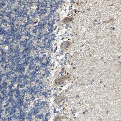 Immunohistochemistry-Paraffin: TM9SF2 Antibody [NBP1-80958]