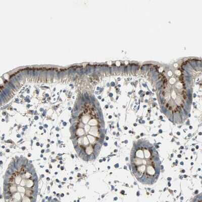 Immunohistochemistry-Paraffin: TM9SF2 Antibody [NBP1-80958]