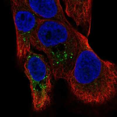 Immunocytochemistry/ Immunofluorescence: TMBIM1 Antibody [NBP2-57847]