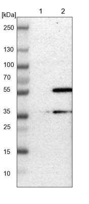 Western Blot: TMBIM1 Antibody [NBP1-81310]