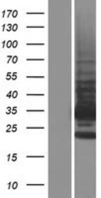 Western Blot: TMBIM1 Overexpression Lysate [NBP2-06458]