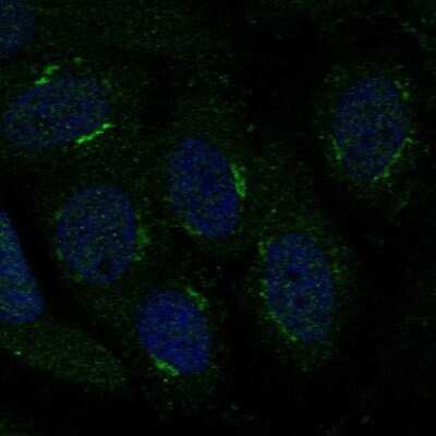 Immunocytochemistry/ Immunofluorescence: TMBIM4 Antibody [NBP2-57908]