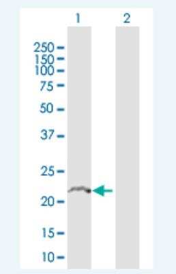 Western Blot: TMBIM4 Antibody [H00051643-B01P-50ug]