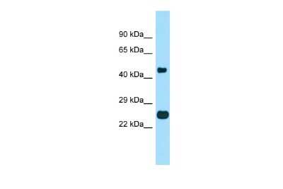 Western Blot: TMBIM4 Antibody [NBP2-85930]