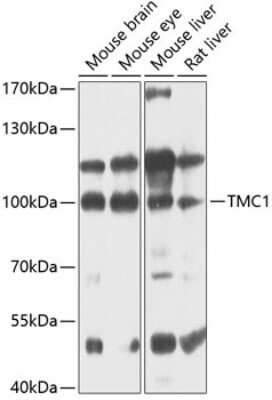 Western Blot: TMC1 AntibodyBSA Free [NBP3-05609]