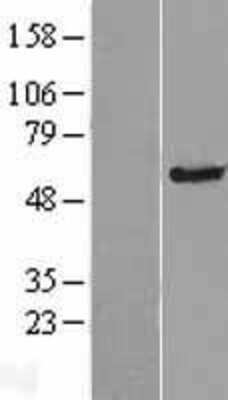 Western Blot: TMC4 Overexpression Lysate [NBP2-05549]