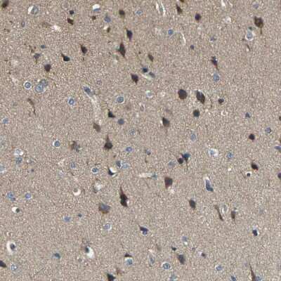 Immunohistochemistry-Paraffin: TMCC2 Antibody [NBP1-93797]