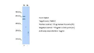 Western Blot: TMCC2 Antibody [NBP2-85932]