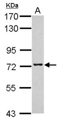 Western Blot: TMCO3 Antibody [NBP2-20660]