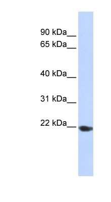 Western Blot: TMED1 Antibody [NBP1-62557]