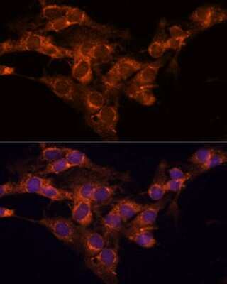 Immunocytochemistry/ Immunofluorescence: TMED2 Antibody - Azide and BSA Free [NBP2-94067]
