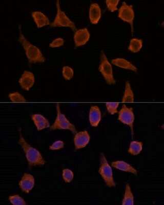 Immunocytochemistry/ Immunofluorescence: TMED2 Antibody - Azide and BSA Free [NBP2-94067]