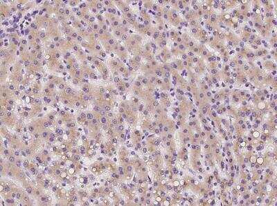 Immunohistochemistry-Paraffin: TMED2 Antibody [NBP3-06498]