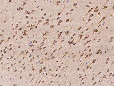 Immunohistochemistry-Paraffin: TMED2 Antibody [NBP3-06498]