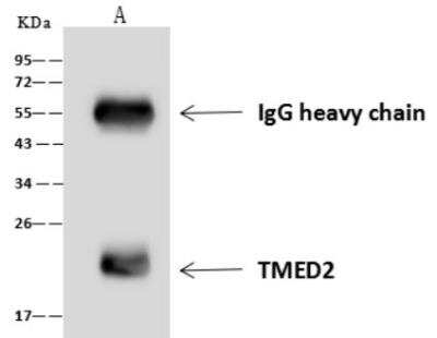 Immunoprecipitation: TMED2 Antibody [NBP3-06498]