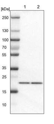 Western Blot: TMED2 Antibody [NBP1-80963]