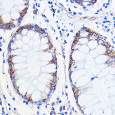 Immunohistochemistry-Paraffin: TMED3 Antibody - Azide and BSA Free [NBP2-94321]