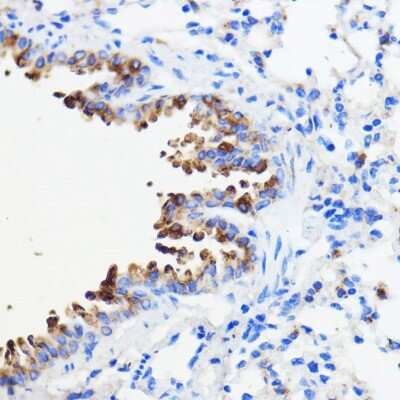 Immunohistochemistry-Paraffin: TMED3 Antibody - Azide and BSA Free [NBP2-94321]
