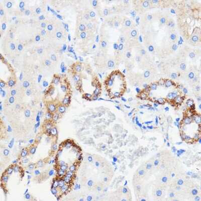 Immunohistochemistry-Paraffin: TMED3 Antibody - Azide and BSA Free [NBP2-94321]