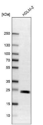 Western Blot: TMED9 Antibody [NBP1-83193]