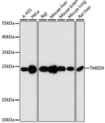 Western Blot: TMED9 AntibodyAzide and BSA Free [NBP2-94854]