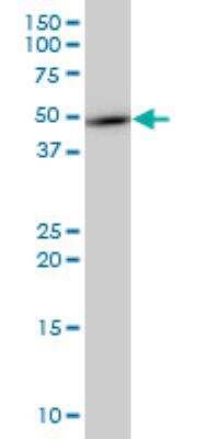 Western Blot: TMEFF2/Tomoregulin-2 Antibody (1D12) [H00023671-M08]