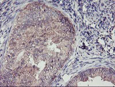 Immunohistochemistry-Paraffin: TMEFF2/Tomoregulin-2 Antibody (OTI1F9) [NBP2-01863]