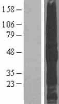 Western Blot: TMEFF2/Tomoregulin-2 Overexpression Lysate [NBL1-16988]