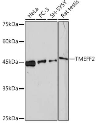 Western Blot: TMEFF2/Tomoregulin-2 Antibody (6K5Q9) [NBP3-16335]