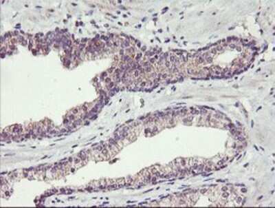 Immunohistochemistry: TMEFF2/Tomoregulin-2 Antibody (OTI1F9) - Azide and BSA Free [NBP2-74537]