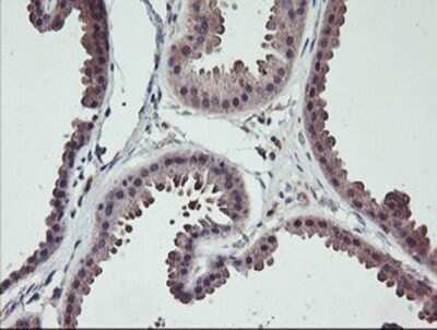 Immunohistochemistry: TMEFF2/Tomoregulin-2 Antibody (OTI1F9) - Azide and BSA Free [NBP2-74537]