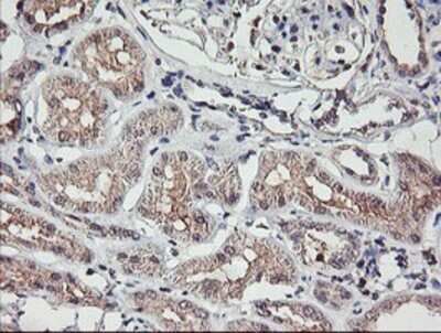 Immunohistochemistry: TMEFF2/Tomoregulin-2 Antibody (OTI1F9) - Azide and BSA Free [NBP2-74537]