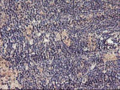 Immunohistochemistry: TMEFF2/Tomoregulin-2 Antibody (OTI1F9) - Azide and BSA Free [NBP2-74537]