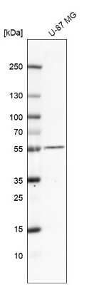 Western Blot: TMEFF2/Tomoregulin-2 Antibody [NBP1-84362]