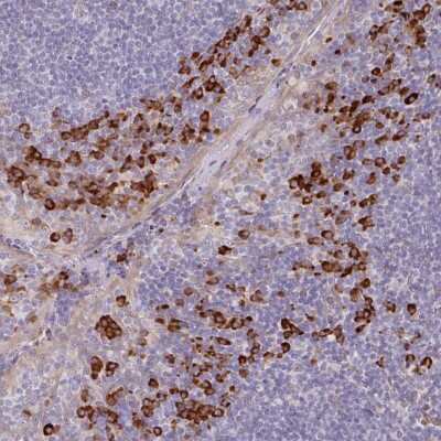 Immunohistochemistry-Paraffin: TMEM1 Antibody [NBP2-48963]