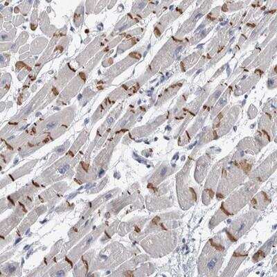 Immunohistochemistry-Paraffin: TMEM102 Antibody [NBP1-83484]