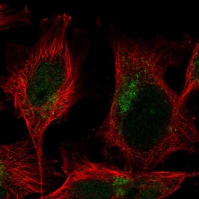 Immunocytochemistry/ Immunofluorescence: TMEM104 Antibody [NBP1-92515]