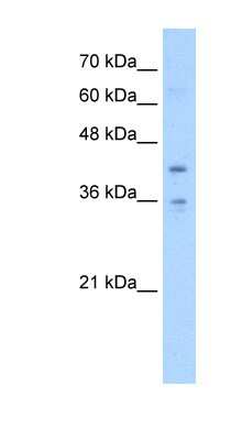 Western Blot: TMEM104 Antibody [NBP1-59389]