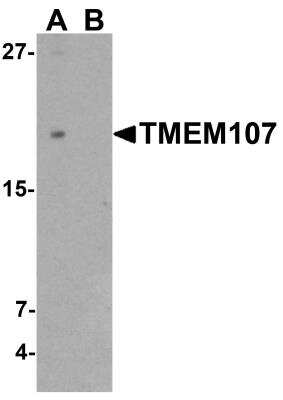 Western Blot: TMEM107 AntibodyBSA Free [NBP2-81865]