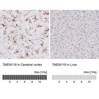 Immunohistochemistry-Paraffin: TMEM119 Antibody (CL8714) [NBP2-76985]