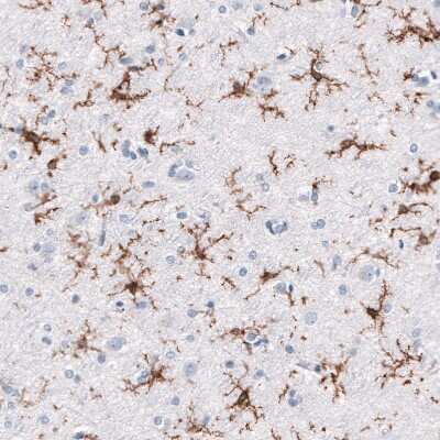 Immunohistochemistry-Paraffin: TMEM119 Antibody (CL8714) [NBP2-76985]