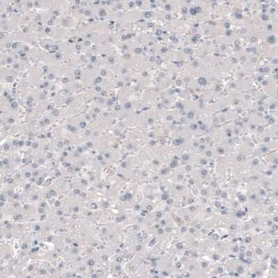 Immunohistochemistry-Paraffin: TMEM119 Antibody (CL8714) [NBP2-76985]