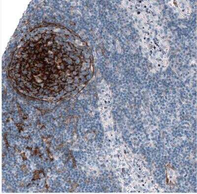 Immunohistochemistry-Paraffin: TMEM119 Antibody (CL8714) [NBP2-76985]