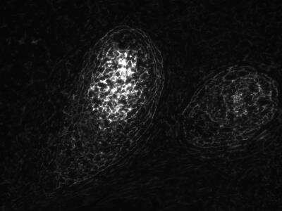 Immunohistochemistry-Paraffin: TMEM119 Antibody (CL8714) [NBP2-76985]