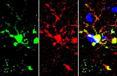 Immunohistochemistry-Frozen: TMEM119 Antibody [NBP3-13355]