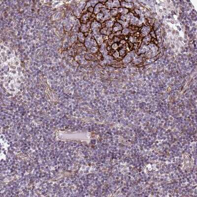 Immunohistochemistry-Paraffin: TMEM119 Antibody [NBP2-30792]