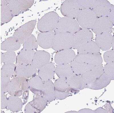 Immunohistochemistry-Paraffin: TMEM121 Antibody [NBP2-14693]